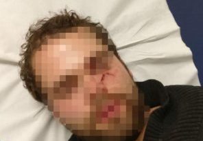 Agression antisémite à Paris